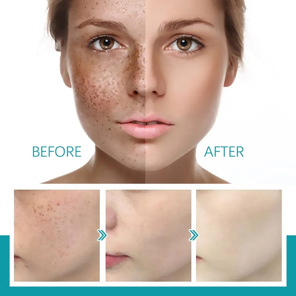 Serum Blanqueador Facial + Envío Gratis