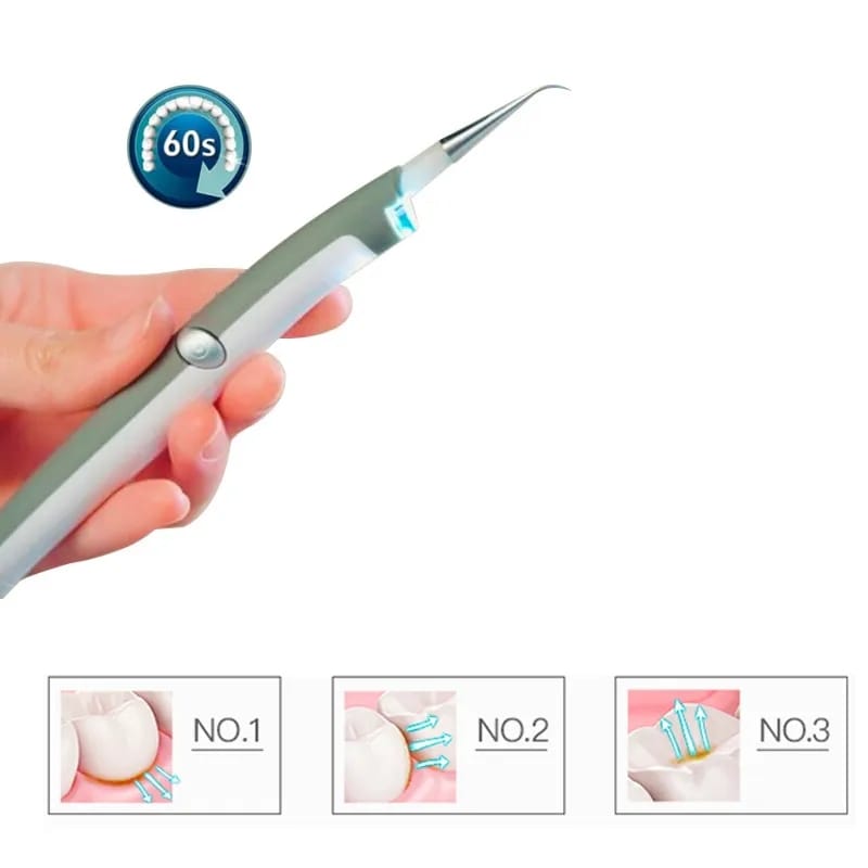 Removedor Electrico De Placa Dental + Envío Gratis 
